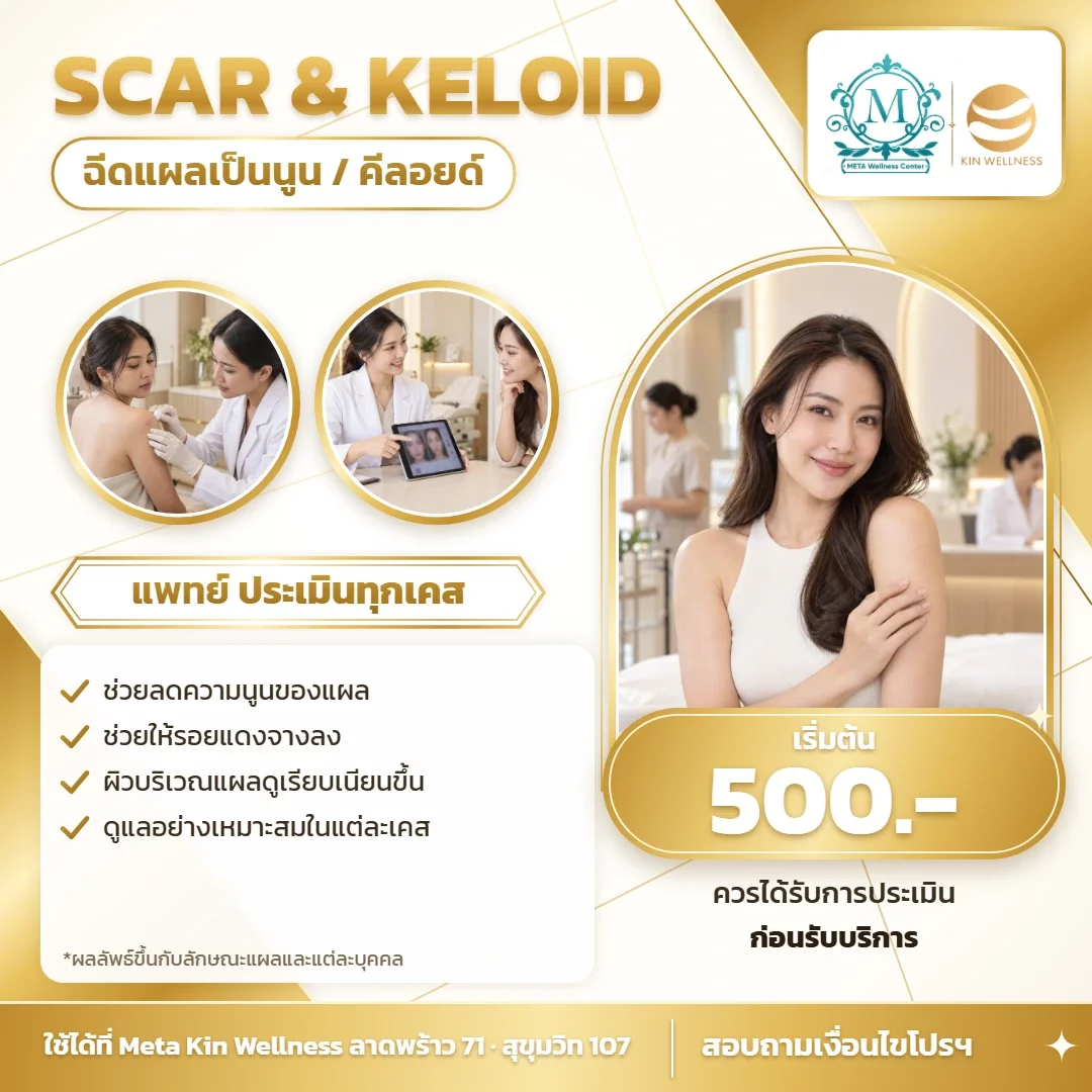 โปสเตอร์ ฉีดแผลเป็นนูน/คีลอยด์ เริ่ม 500 Meta Kin Wellness