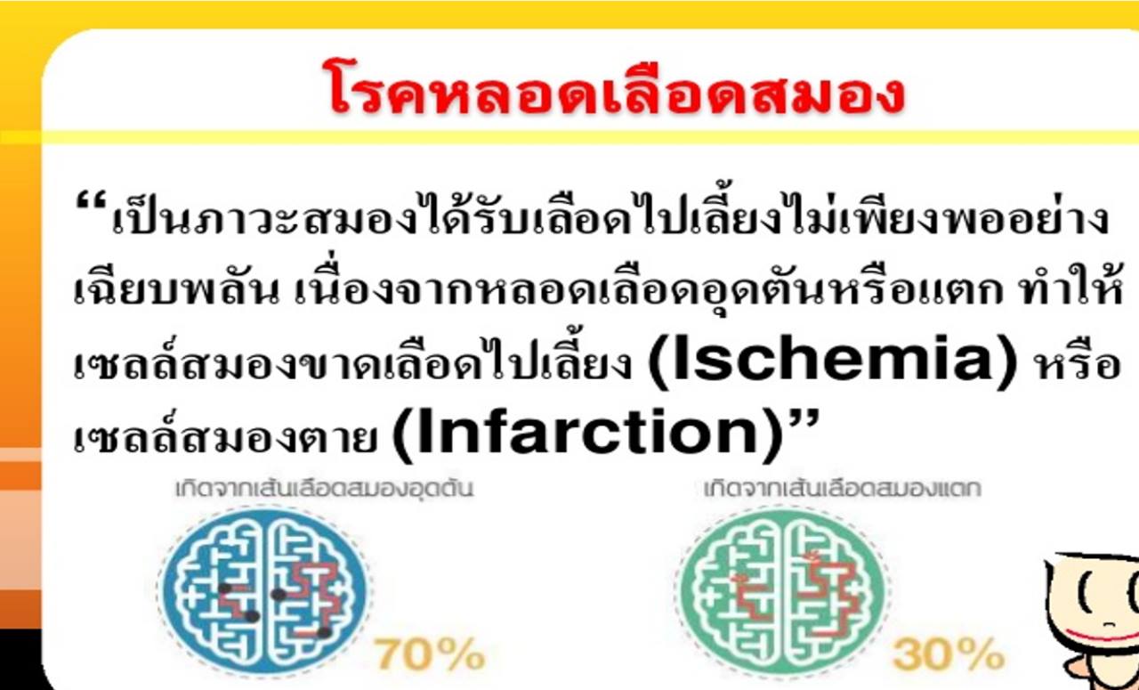 โรคหลอดเลือดสมอง STROKE