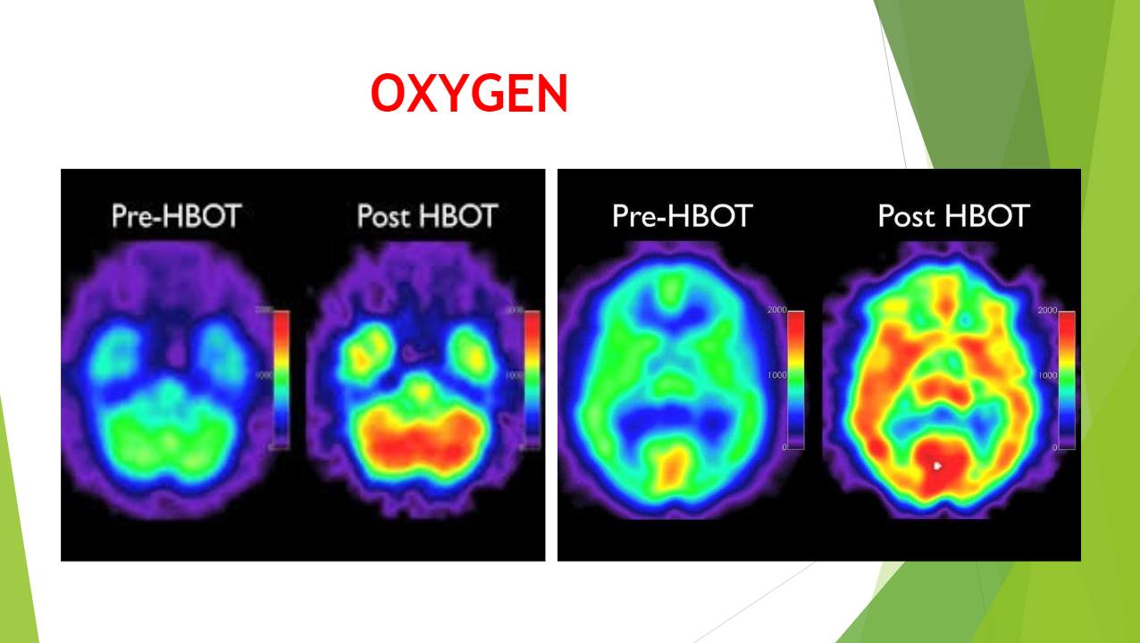 oxygen therapy