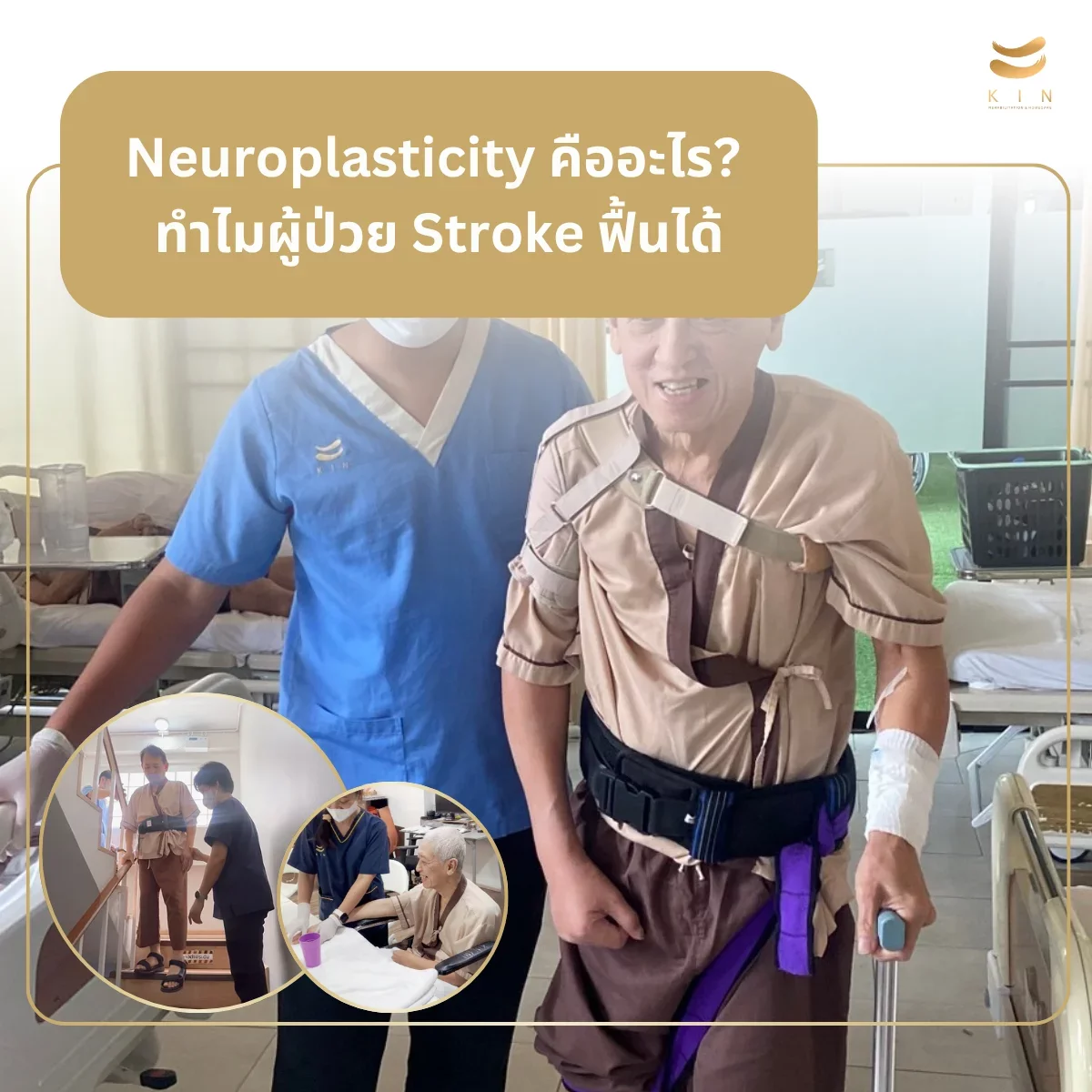 Neuroplasticity คืออะไร? ทำไมผู้ป่วย Stroke ฟื้นได้