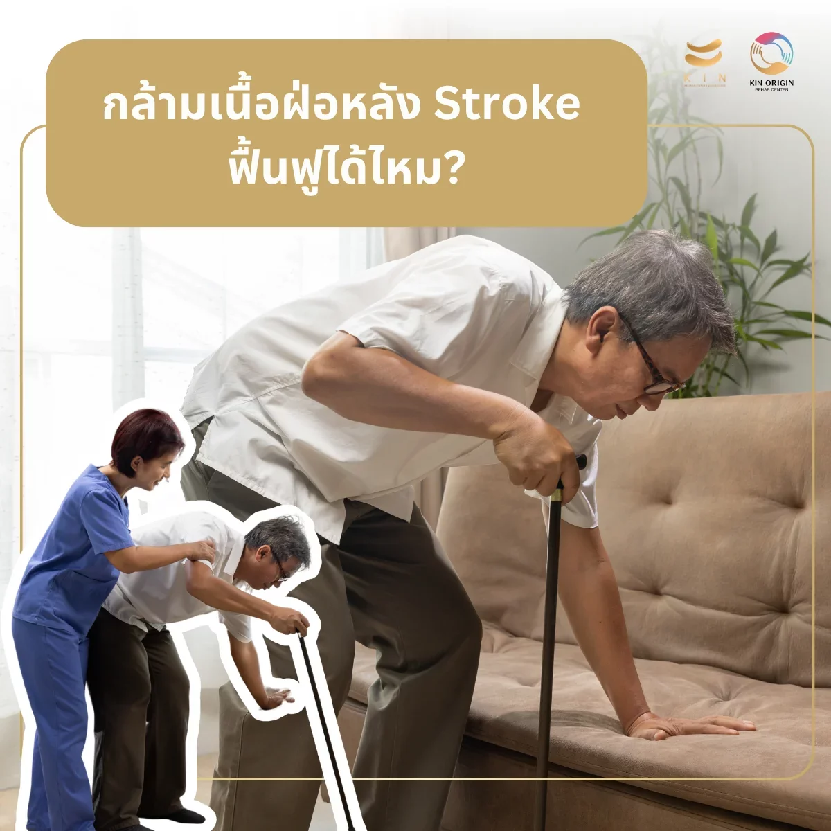 กล้ามเนื้อฝ่อหลัง Stroke ฟื้นได้ไหม? สัญญาณ สาเหตุ และวิธีฟื้นฟูที่ถูกต้อง