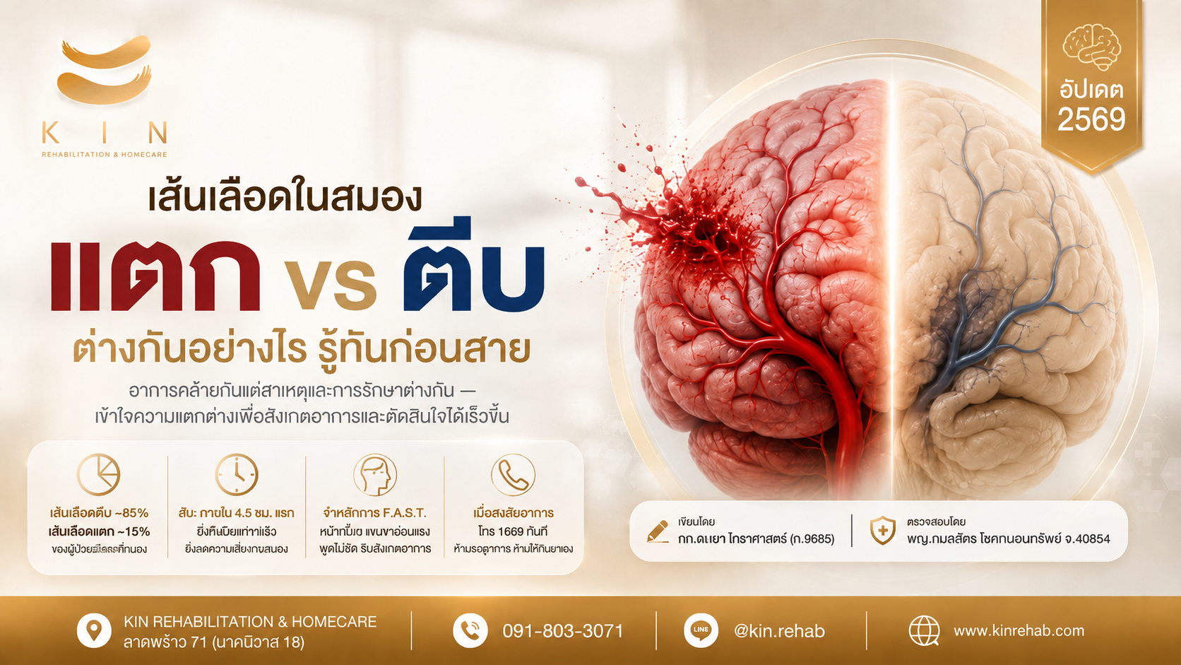 เส้นเลือดในสมองแตก vs ตีบ ต่างกันอย่างไร รู้ทันก่อนสาย