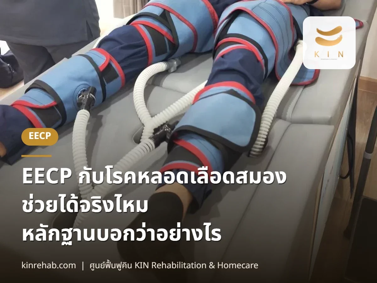 EECP กับโรคหลอดเลือดสมอง ช่วยได้จริงไหม หลักฐานบอกว่าอย่างไร