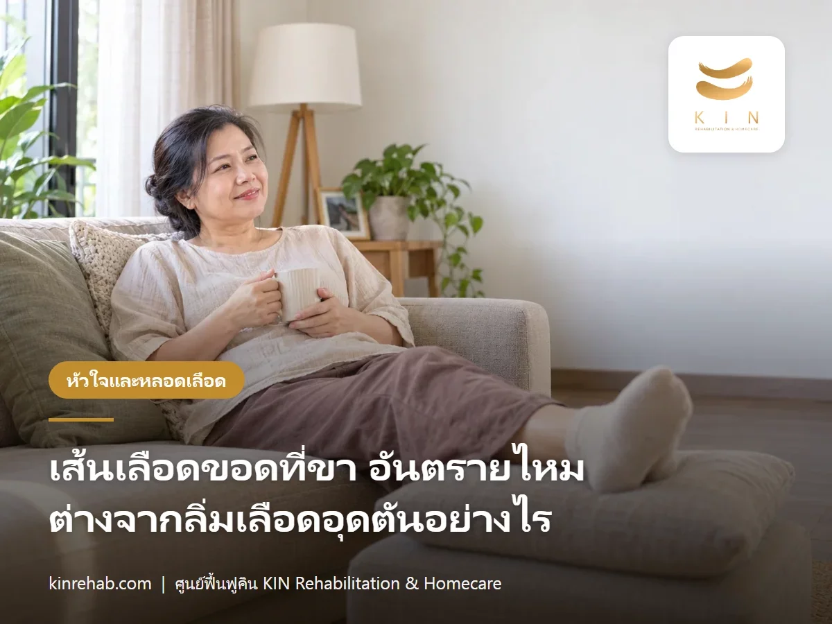 เส้นเลือดขอด อันตรายไหม ต่างจากลิ่มเลือดอุดตันอย่างไร และเมื่อไรต้องพบแพทย์
